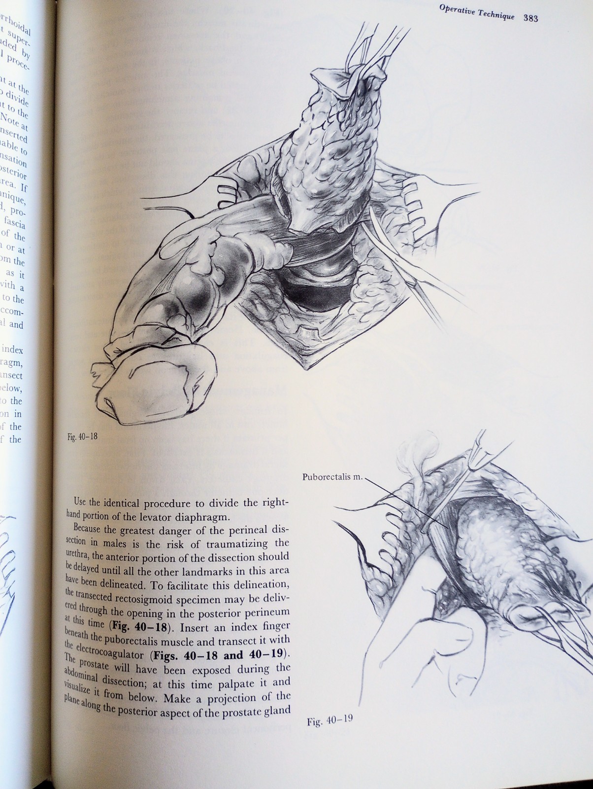 Chassin’s Operative Strategy in General Surgery 2nd Edition Hardcover GREAT COND