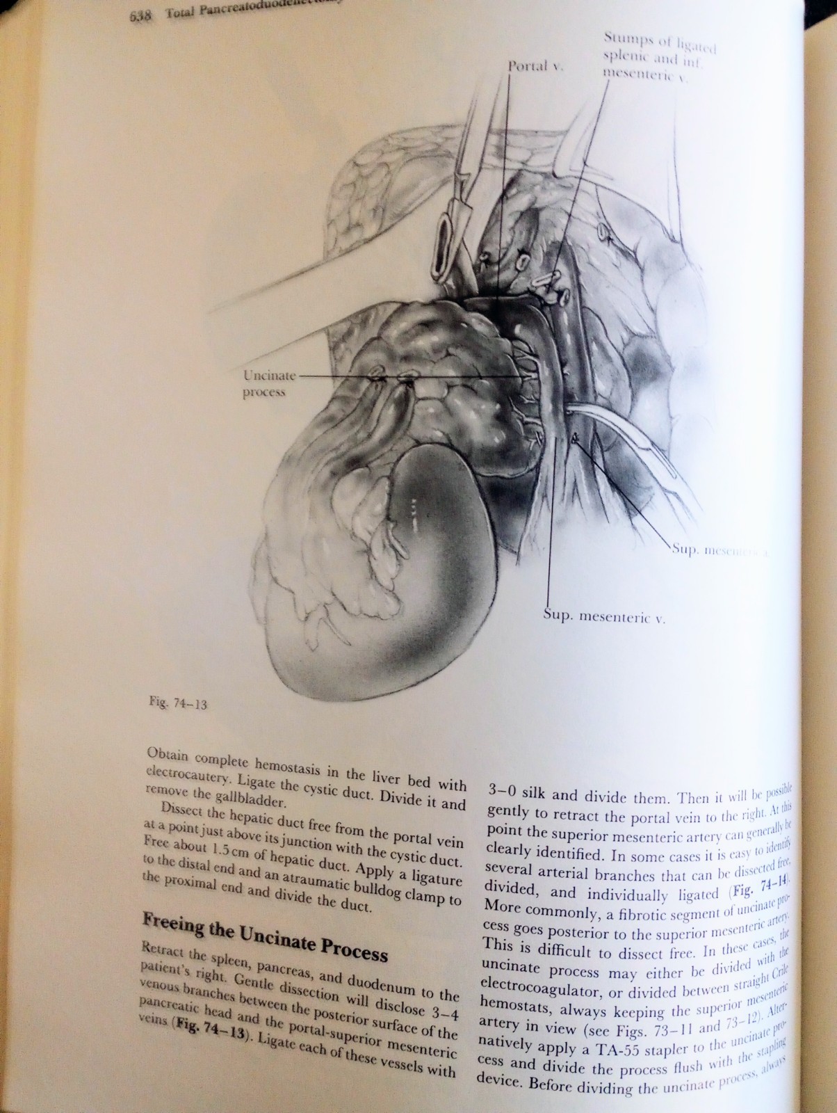 Chassin’s Operative Strategy in General Surgery 2nd Edition Hardcover GREAT COND